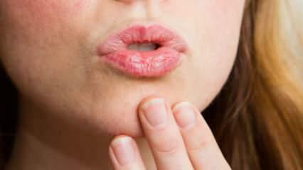 Kaip atlikti lūpų priežiūrą namuose? Lengva sausų lūpų priežiūra 4 žingsniais