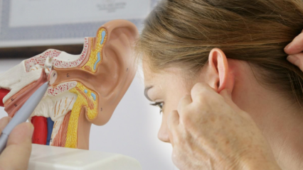 Kas yra ausų kalcifikacija (otosklerozė)? Kokie yra ausų kalcifikacijos (otosklerozės) simptomai?